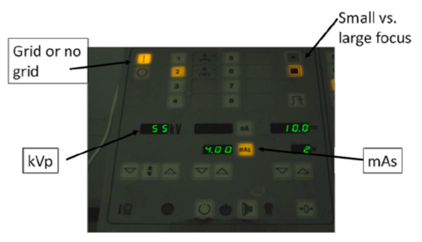 <p>- On/Off switch<br>- mA (tube current)<br>- Time (seconds or less)<br>- kVp (kilovolts peak)<br>- Exposure button/foot pedal</p>