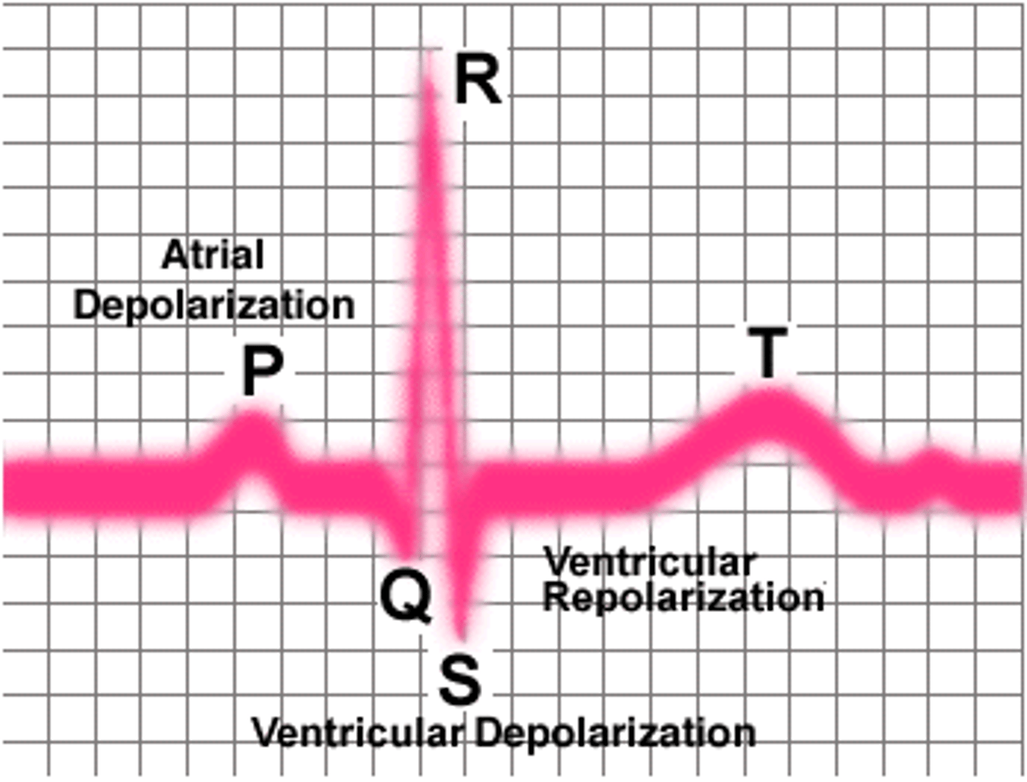 <p>electrocardiogram</p>