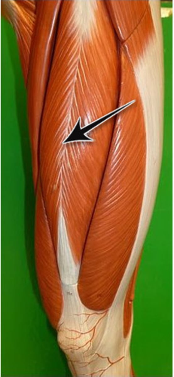 <p>Quadriceps muscle that extends the knee</p><p>thigh and leg muscle</p>