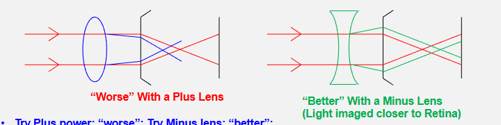 <p>worse with a plus lense as light images further from the retina </p><p>better with minus as light imaged closer to the retina </p><p>keep increasing the minus lens power until no further improvement </p>