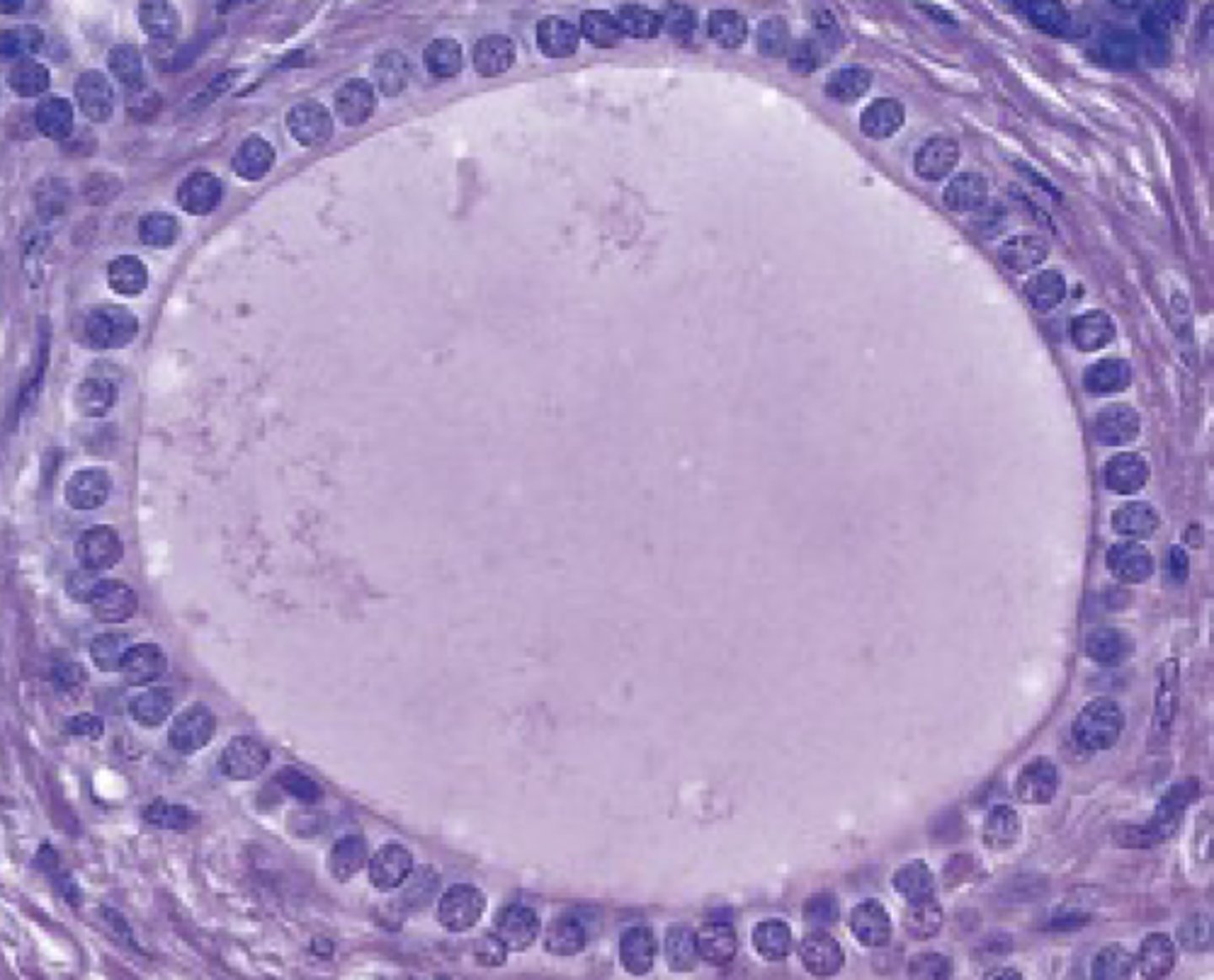 <p>classify the epithelium</p>