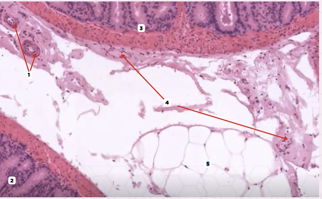 <p>What kind of connective tissue present in this layer binds the highly coiled seminal vesicle?</p><p>A. Dense Regular CT</p><p>B. Dense Irregular CT</p><p>C. Loose Connective Tissue</p><p>D. Reticular fibers</p>