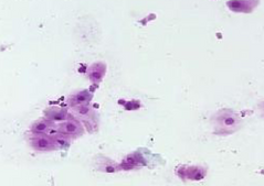 <p>Parabasal cells</p>