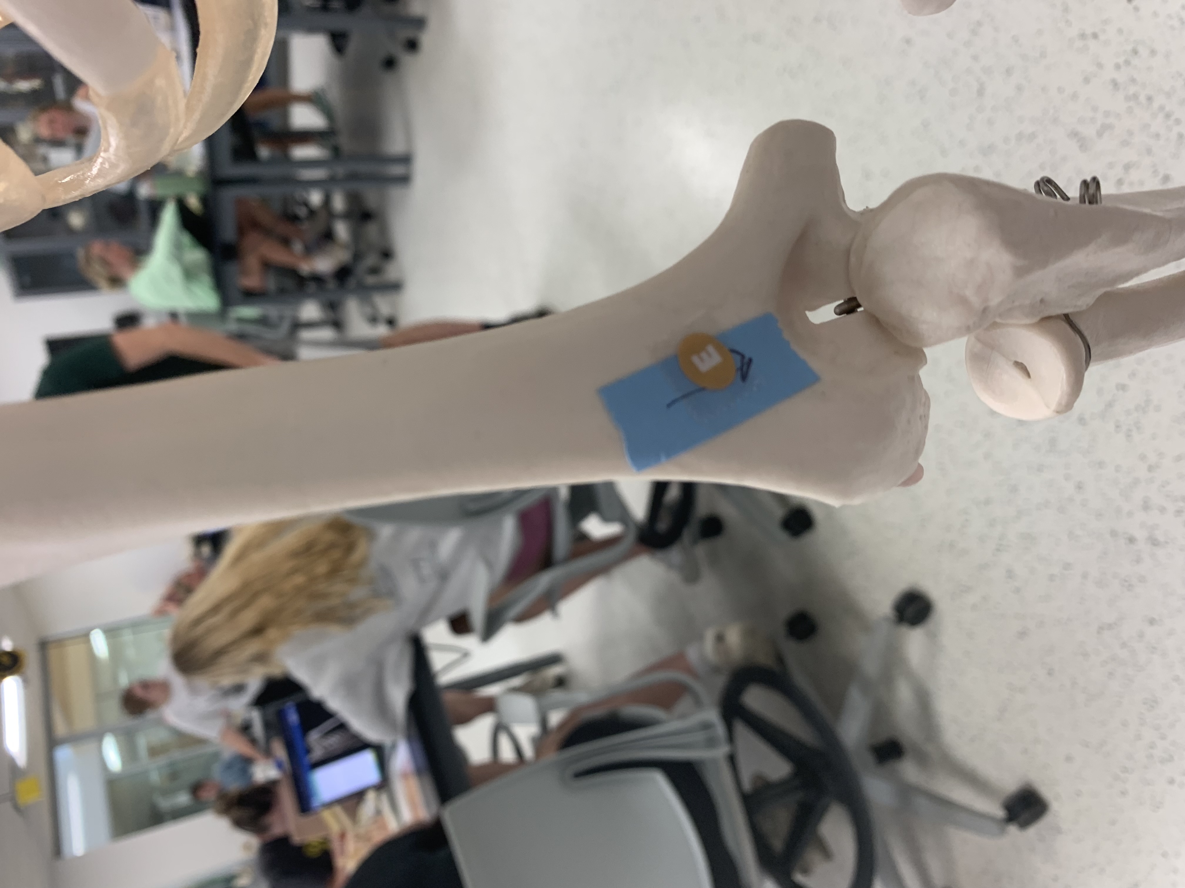 <p>Olecranon Fossa</p>