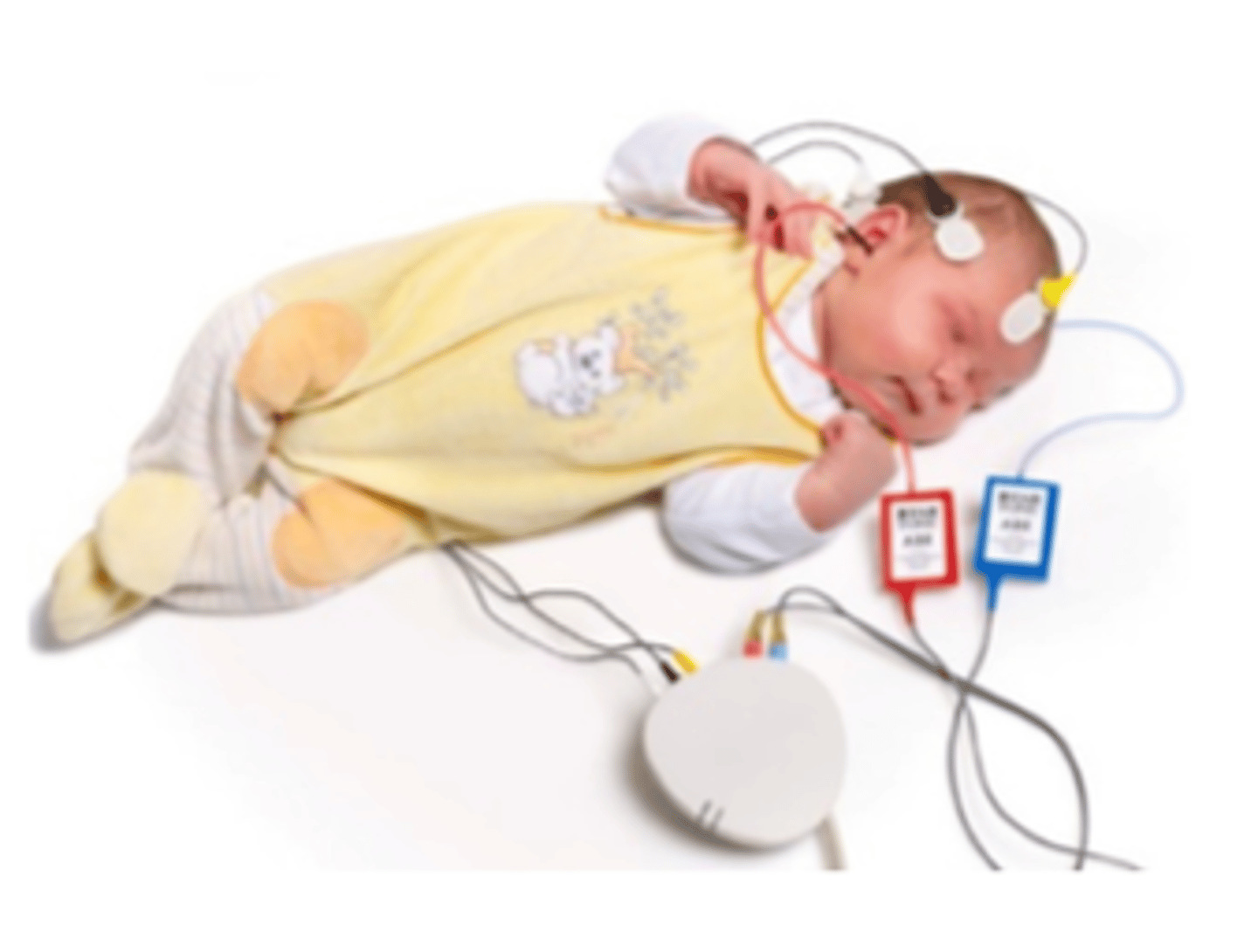 <p>The neural activity that is transmitted from the inner ear to the auditory brainstem and used to measure the threshold of hearing to acoustic stimulation</p><p>Recorded via electrodes on the scalp.</p>