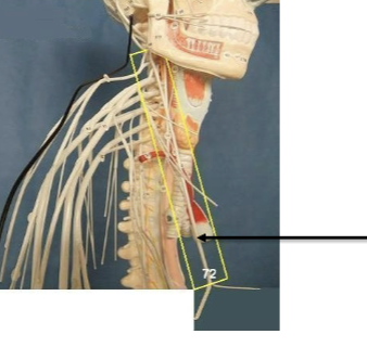 <p>Label nerve </p>