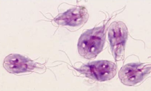 <p>A- what is the method of examination used here</p><p>B-What is the name of organism in</p><p>C- found from what aspirate </p><p></p>