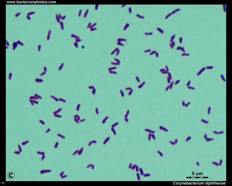 <p>What am i- gram stain, shape, arrangement</p>