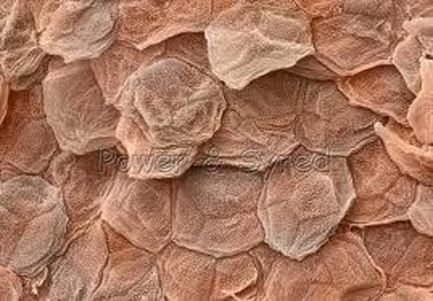 <p>Composed of keratinized stratified squamous epithelium.</p>