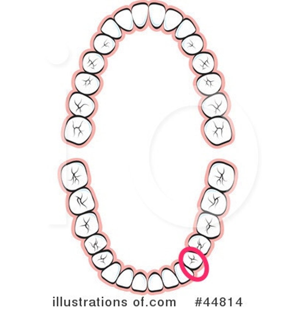 <p>LL 1st premolar</p>
