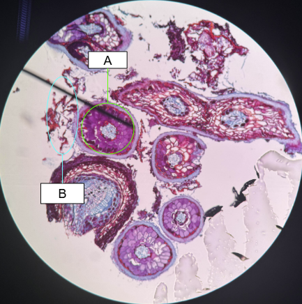 <p>What type of mycorrhizae is this</p>