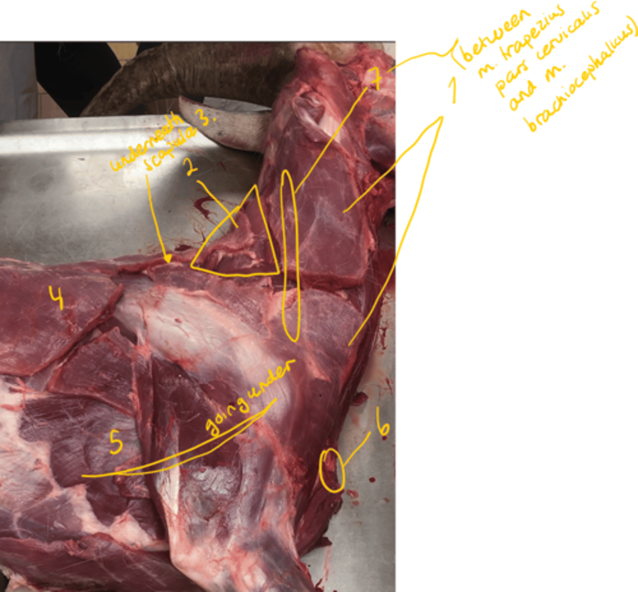 <p>identify muscles (View 2)</p>