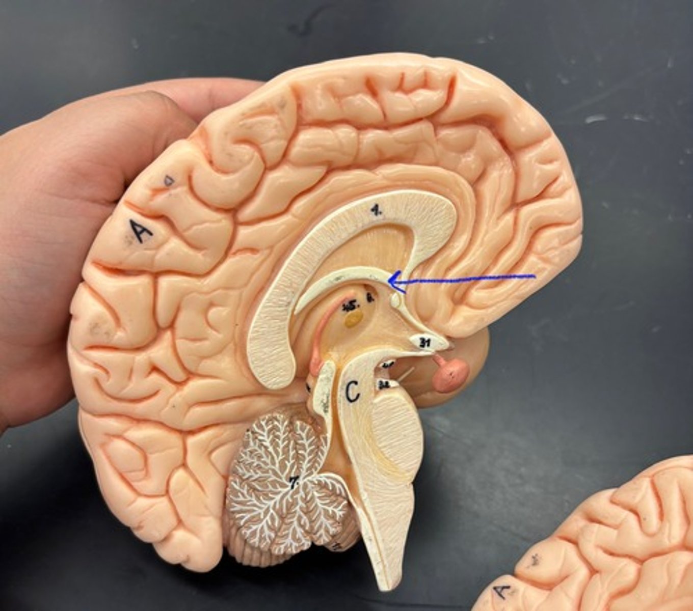 knowt flashcard image