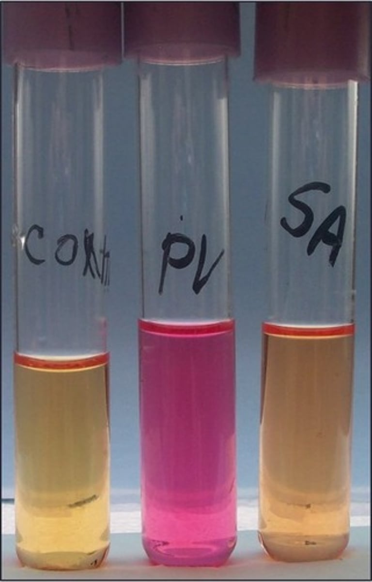 <p>Organism with positive result:</p>