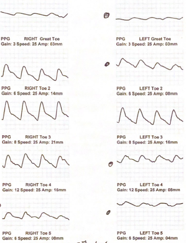 <p>Which digital waveform display evidence of significant obstruction in this digital evaluation?</p>