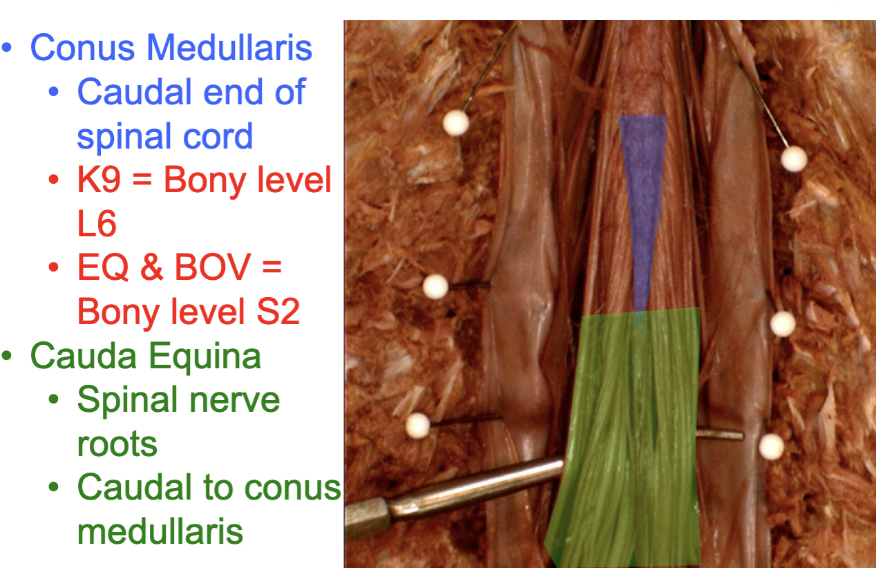 <p>Conus medullaris</p>