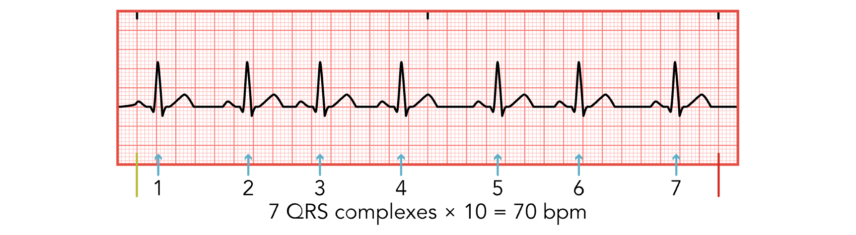 <p>7 X 10 = 70 bpm </p>