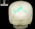 <p>irregular bone within a cranial suture</p>