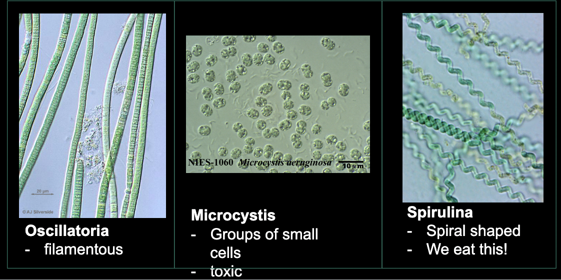 <p>What bacteria is this?</p>