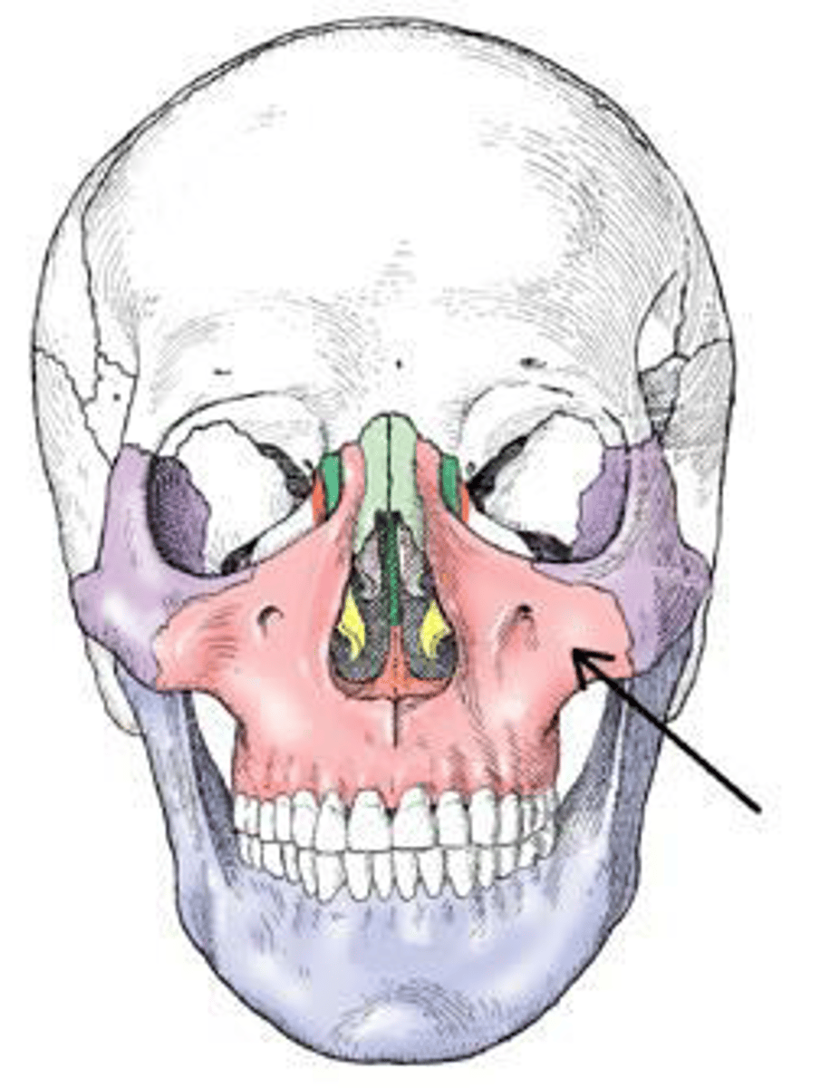 <p>a. maxilla.</p><p>3 multiple choice options</p>