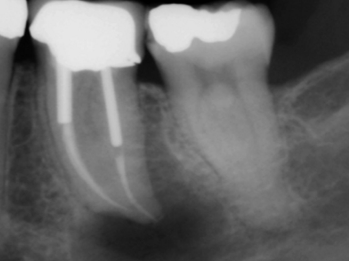 <p>ID the procedural error:</p>