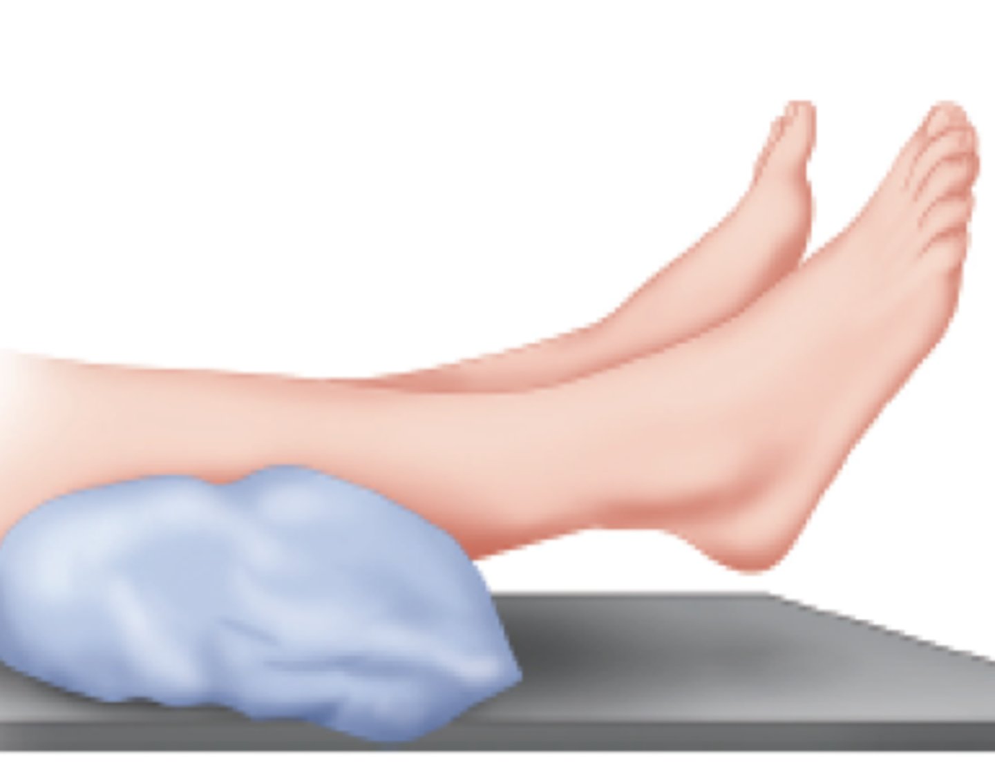 <p>pillow is placed under ankle to allow the heel to hang over the pillow</p>
