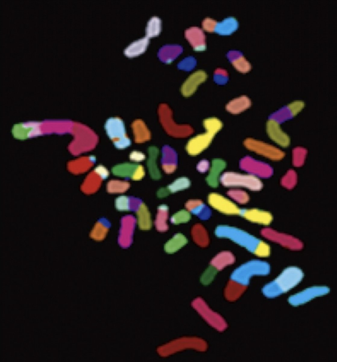 <p>chromosomes present in:</p><p>- inappropriate numbers &amp;/or</p><p>- structural abnormalities</p><p>present in >85% solid tumors</p>
