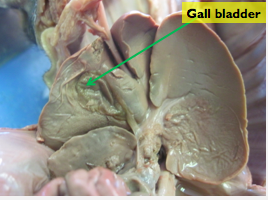 stores bile produced in the liver. one of the components of bile is a by-product of the breakdown of hemoglobin.