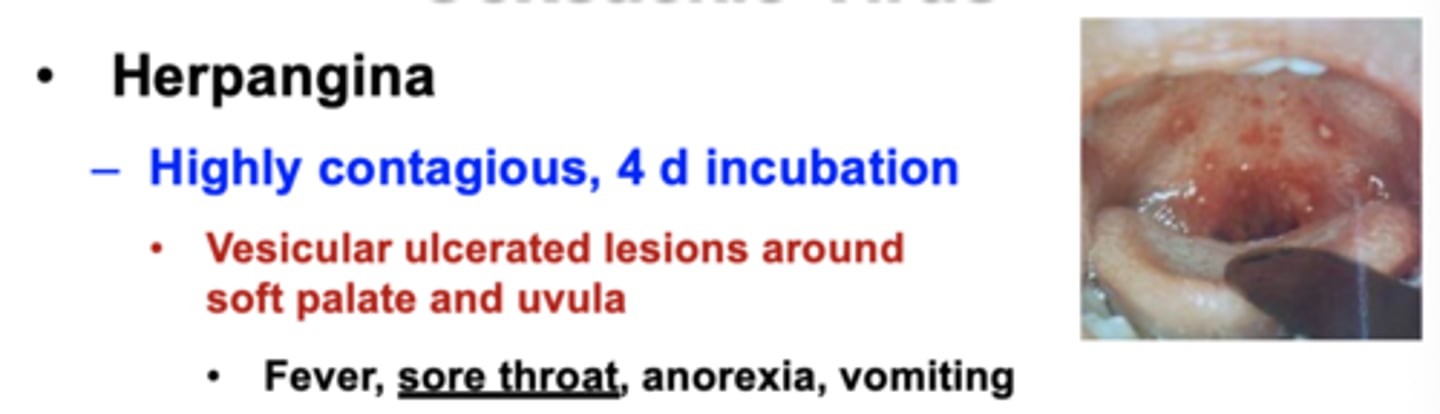 <p><strong>Highly contagious, 4 d incubation</strong></p><p>•<span style="text-decoration:underline">Vesicular ulcerated lesions</span> around soft palate and uvula</p><p>•Fever, <span style="text-decoration:underline">sore throat</span>, anorexia, vomiting</p>
