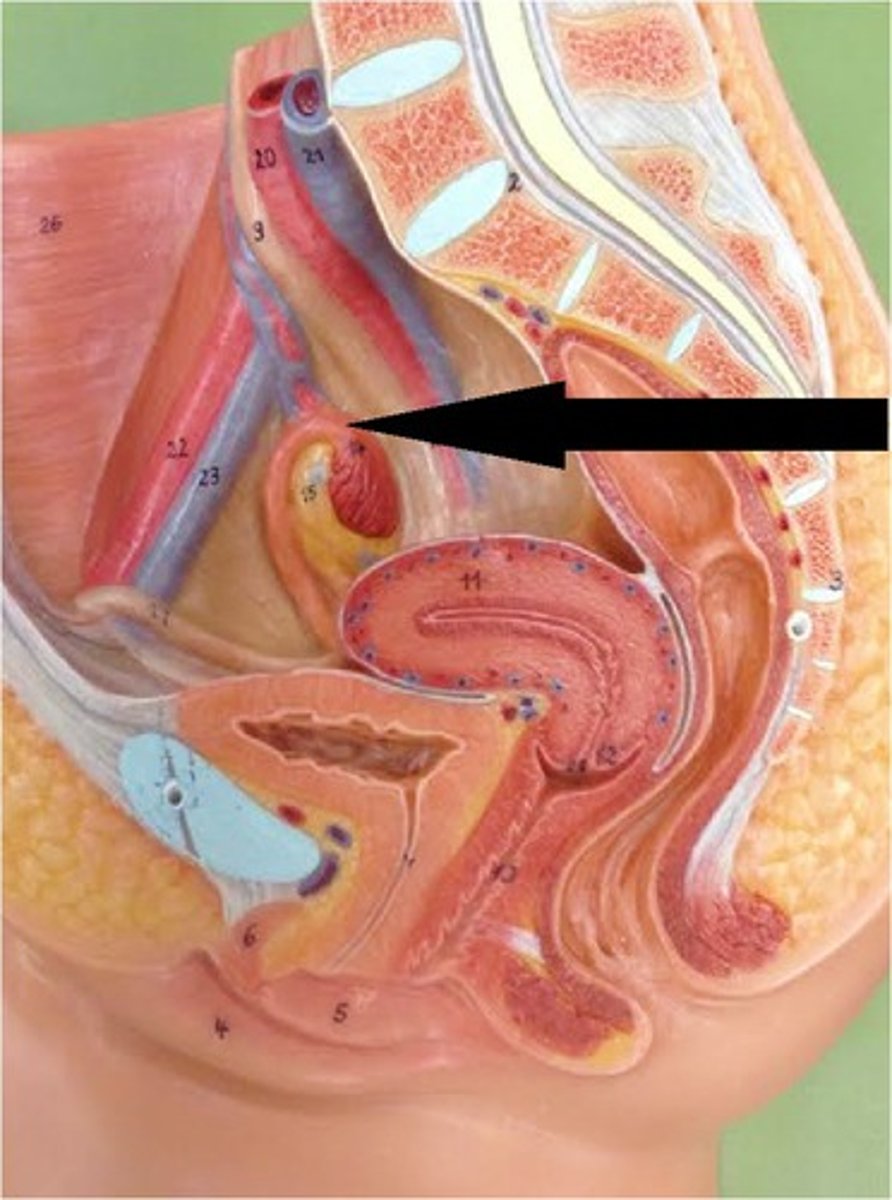 <p>Funnel shaped lateral tube projects beyond broad ligament to overlie ovaries and captures the oocyte, a usual site of fertilization before it moves into the uterus for implantation</p>