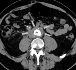 <p>What imaging modality is seen here?</p>