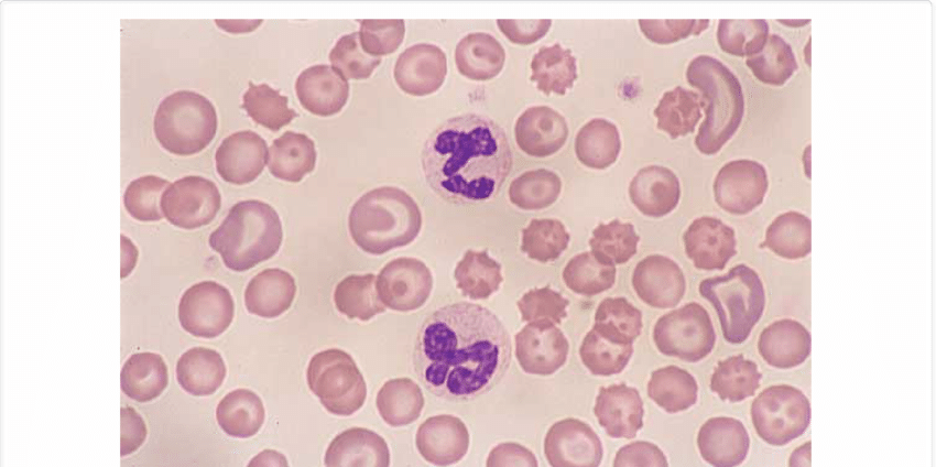 <p>blood;</p><p> cell, sp</p>