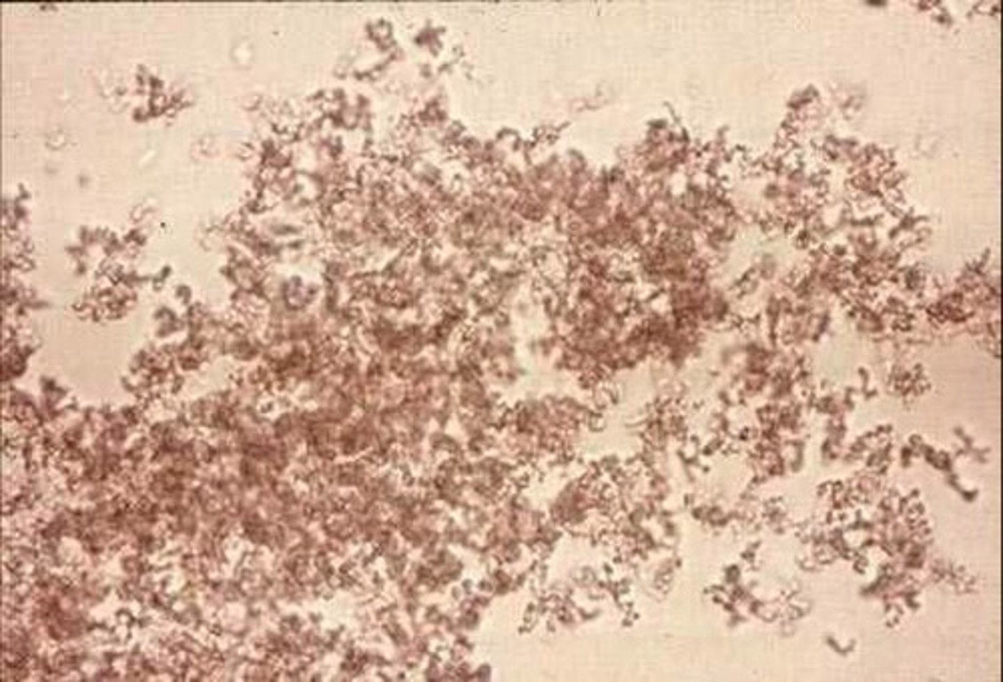 <p>Found in acid urine that's been in the fridge <br>Pink macroscopic precipitate <br>Can be dissolved by warming</p>