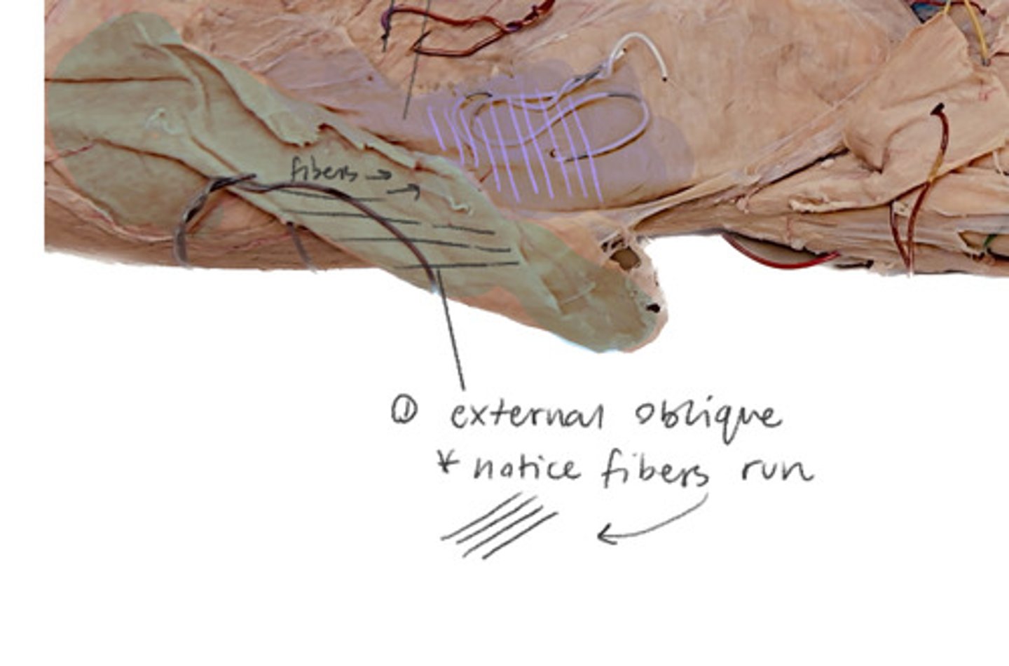 <p>Outermost abdominal muscle</p>