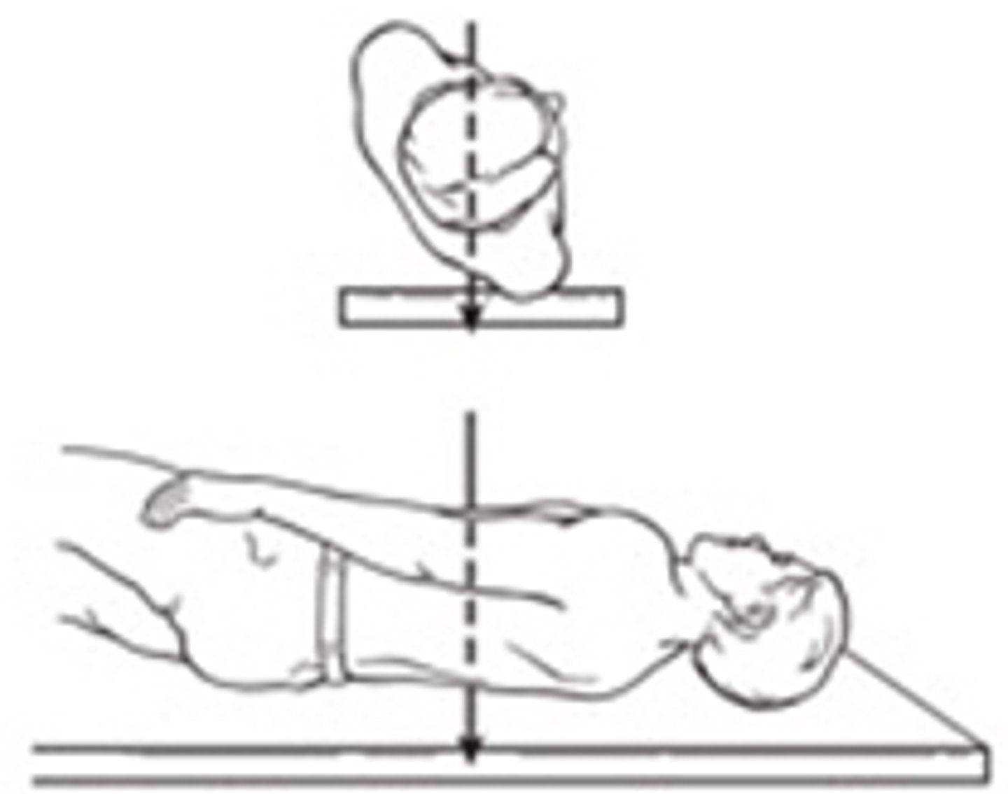 <p>Right Posterior Oblique</p>