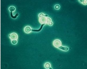 <p>germ tube = non-constricting tube str from yeast after 2-4 hrs of incubation in fetal bovine serum</p><p></p><p>C. albicans + in 37C &amp; 42C</p><p>C. dubliensis + in 37C, but - in 42C</p><p></p><p>if + → presumptive ID for either C. albicans or C. dubliensis</p>