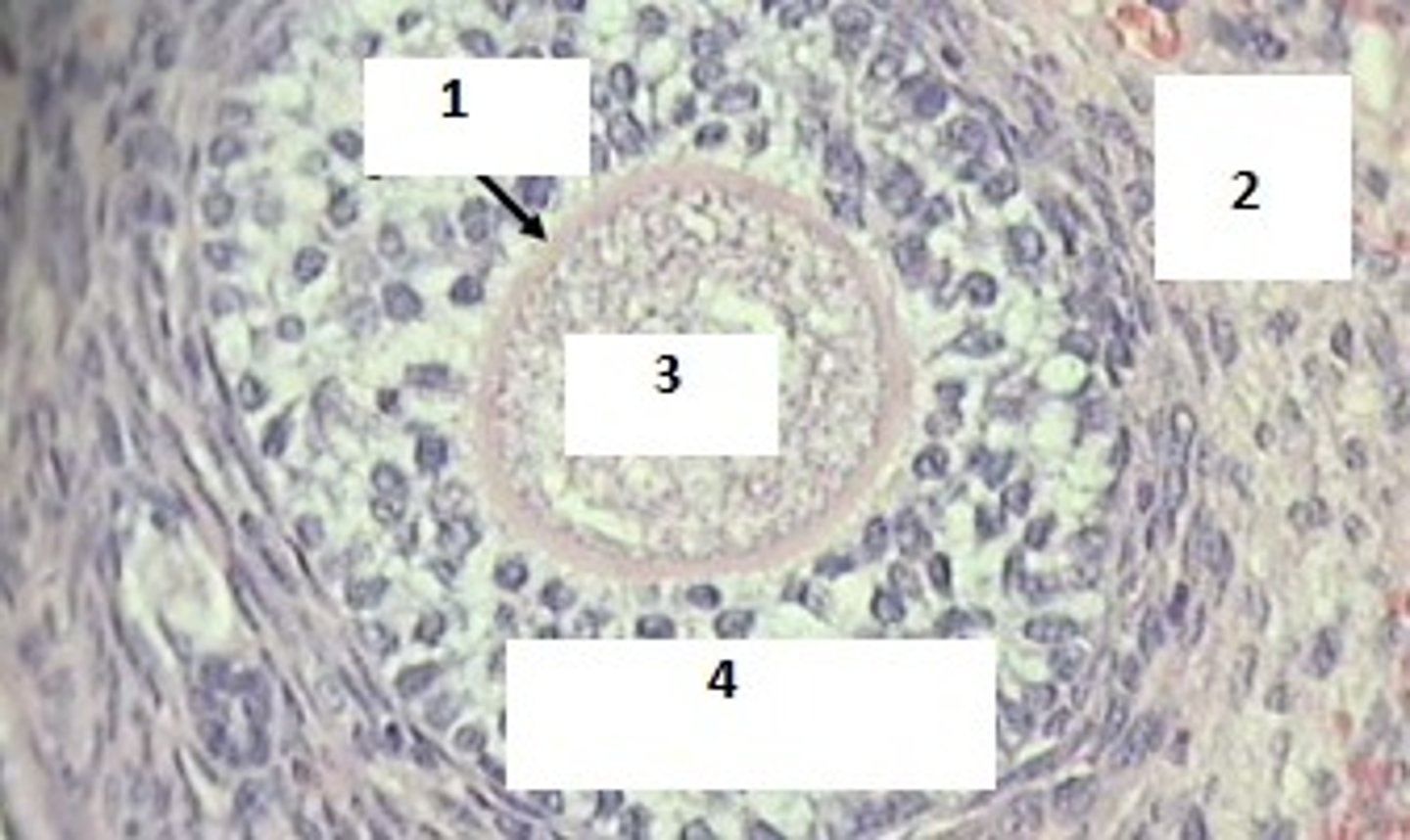 <p>Identify the follicle &amp; #1-4</p>