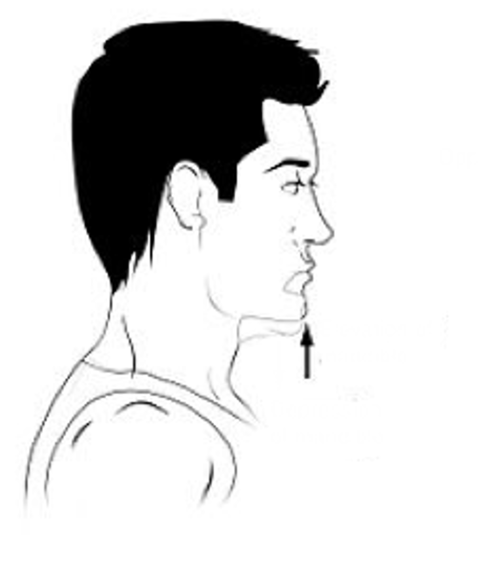 <p>Identify the action indicated by the arrow.</p>