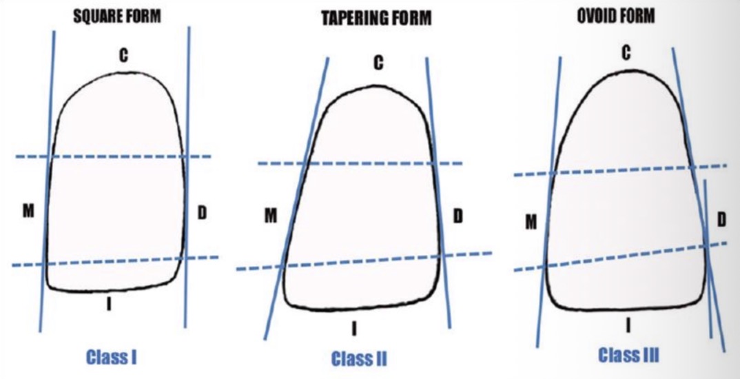 <p>2-3mm wider than lateral ones</p><p>Canines are 1-1.5mm wider than the lateral incisors</p><p>Distal edge more convex than mesial- </p><p>Shape- square, ovoid, triangular </p>