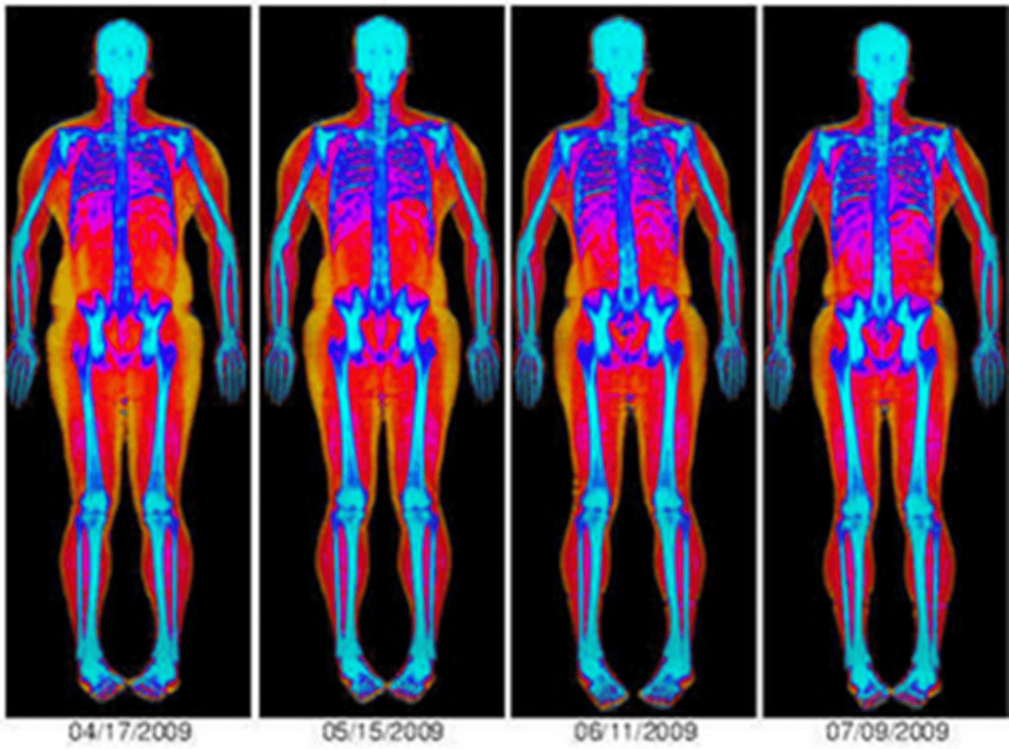 <p>How much fat, muscle, and bone your body has</p>