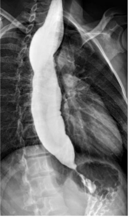 <p>What is this </p>