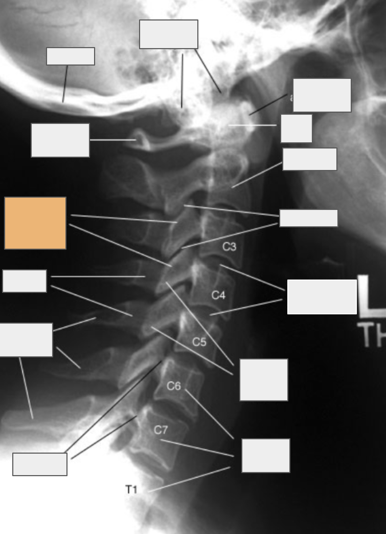 <p>What structure of the spine does the box highlighted in orange reference to?</p>