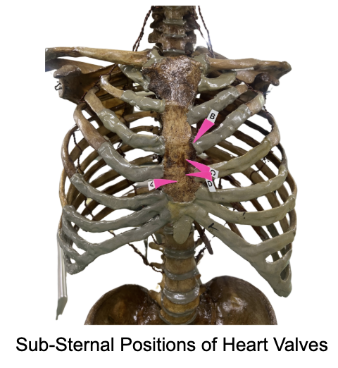 <p>Which of these is pointing to: <span>Left half of the sternum (Opposite to the 3rd ICS, Left)</span></p>
