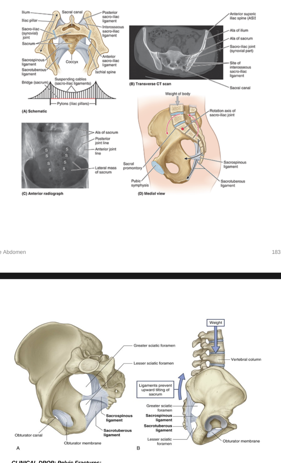 <ul><li><p>Lumbosacral joint —</p><ul><li><p>Symphysis (secondary cartilaginous) joint between L5 &amp; sacral base, allowing flexion, extension, lateral flexion, &amp; minimal rotation of torso with respect to pelvis &amp; lower limbs</p></li><li><p>Consist of 2 zygapophyseal joints (between inferior &amp; superior articulatory processes) &amp; an intervertebral disc between L5 &amp; S1</p></li><li><p>Reinforced by strong iliolumbar ligaments (L5-ilium) and lumbosacral ligaments (L5-sacrum), which specifically originate from the expanded transverse processes of this vertebrae </p></li></ul></li><li><p>Sacrococcygeal joint —</p></li><li><p>Sacroiliac joint —</p><ul><li><p>L-shaped synovial joint between ala of sacrum &amp; auricular surface of ilium</p></li><li><p>Allows very little mobility through slight gliding &amp; rotation movments</p></li><li><p>In women, ligaments of the joint soften during pregnancy to enable increase of pelvic diameter during childbirth </p></li><li><p>Each joint stabilized by 3 ligaments —</p><ul><li><p>Anterior sacro-iliac ligament — thickening of fibrous membrane of joint capsule, running anteroinferiorly to the joint</p></li><li><p>Interosseous sacro-iliac ligament — largest &amp; strongest of the 3, attaches to adjacent expansive roughened areas on the ilium &amp; sacrum, thus filling the gap between the 2 bones</p></li><li><p>Posterior sacro-iliac ligament — covers the iterosseous sacro-iliac ligament </p></li></ul></li></ul></li><li><p>Pubic symphysis —</p><ul><li><p>secondary cartilaginous joint between medial surfaces of the pubic bones — the surfaces lined by a layer of hyaline cartilage &amp; connected by the fibrous symphyseal cartilage between them by fibrocartilage</p></li><li><p>Usually no movements except in pregnancy when ligaments &amp; cartilage soften to increase pelvic diameter during labor </p></li><li><p>The joint is surrounded by interwoven layers of collagen fibers &amp; the 2 major ligament associated to it are —</p><ul><li><p>Superior pubic ligament — above the joint</p></li><li><p>Inferior pubic ligament — below the joint</p></li></ul></li></ul></li></ul>