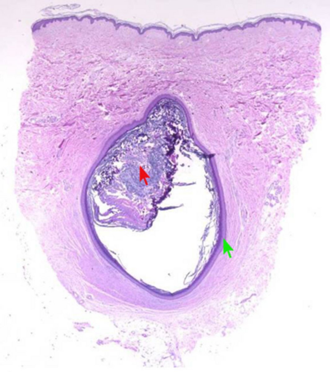 <p>1. connective tissue wall</p><p>2. epithelial layer/lining</p><p>3. lumen (often fluid-filled, but not always)</p>