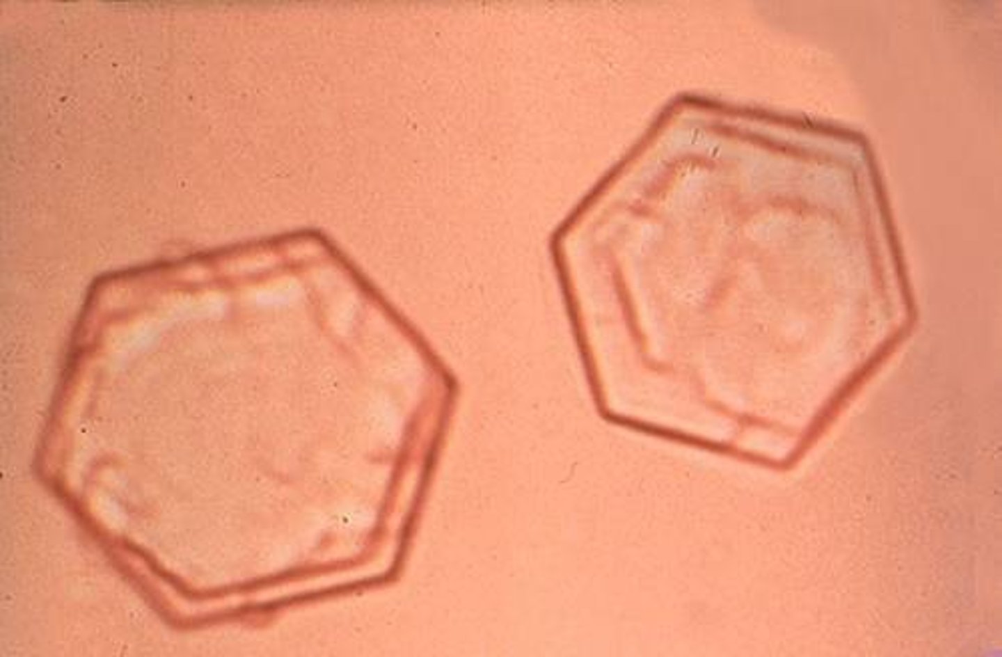 <p>- Acid pH</p><p>- Colorless, hexagonal plates</p><p>- Inherited cystinuria, means that they don't reabsorb cystine in the tubules so they are more prevalent to forming renal calculi</p>