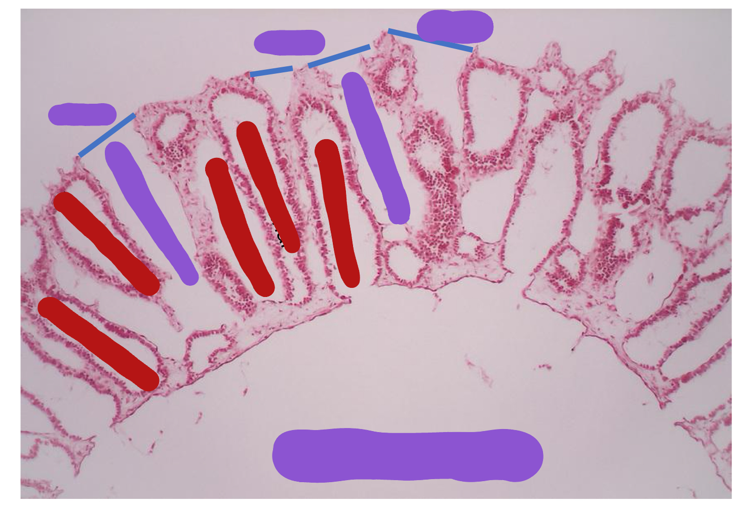 <p><span>Identify the red structure</span></p>