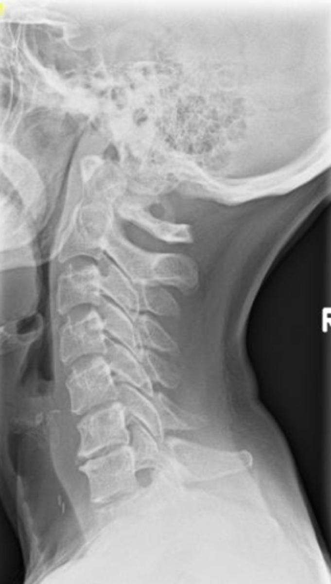 <p>Can you adjust this patient?</p>