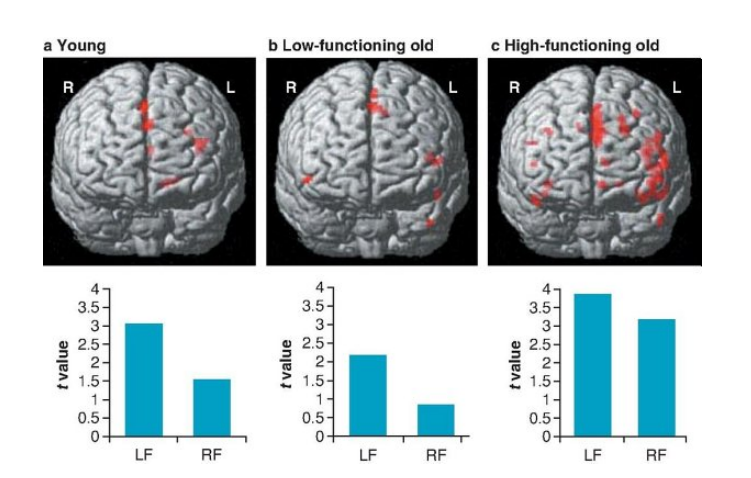 <p>Older adults often show brain activity that is spread out over a ___ area, including both hemispheres, compensating for neural losses</p>