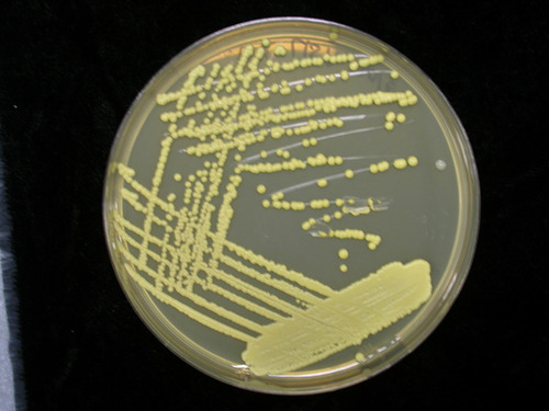 A dilution method to spread a colony or loopful of bacteria across a plate to be able to observe isolated colonies